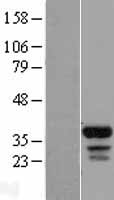 FAM133B Human Over-expression Lysates NM_152789