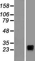 ls259197 ncr3 human over expression lysates nm 147130 wb testing 1