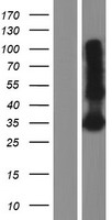 LY6G6F Human Over-expression Lysates NM_001003693