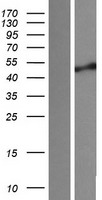 Sphingomyelin Synthase 1 (SGMS1) Human Over-expression Lysates NM_147156