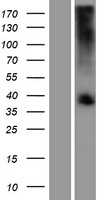 TAS2R39 Human Over-expression Lysates NM_176881