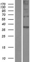 TAS2R44 (TAS2R31) Human Over-expression Lysates NM_176885