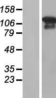 MAGI3 Human Over-expression Lysates NM_152900