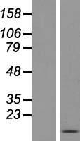 FDCSP Human Over-expression Lysates NM_152997