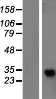 GPR110 (ADGRF1) Human Over-expression Lysates NM_025048