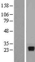 IL28A (IFNL2) Human Over-expression Lysates NM_172138