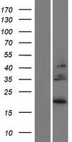 IL28B (IFNL3) Human Over-expression Lysates NM_172139