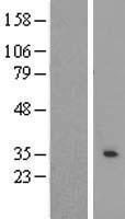 RAB40AL Human Over-expression Lysates NM_001031834