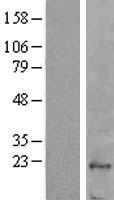 Fucose mutarotase (FUOM) Human Over-expression Lysates NM_198472