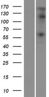 STK32C Human Over-expression Lysates NM_173575