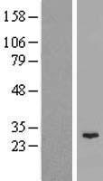 C11orf85 (MAJIN) Human Over-expression Lysates NM_001037225