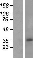 ls283135 c11orf72 human over expression lysates nm 173578 wb testing 1