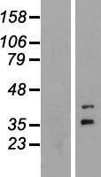 ls283150 foxr1 human over expression lysates nm 181721 wb testing 1