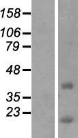 ls283152 ccdc153 human over expression lysates nm 001033658 wb testing 1