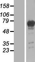 PGM2L1 Human Over-expression Lysates NM_173582