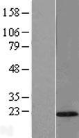 ls283232 tmem80 human over expression lysates nm 174940 wb testing 1