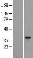 C11ORF77 (HARBI1) Human Over-expression Lysates NM_173811
