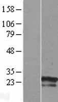 ZNF740 Human Over-expression Lysates NM_001004304