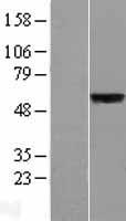 SLC39A5 Human Over-expression Lysates NM_173596