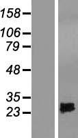 SPRYD4 Human Over-expression Lysates NM_207344