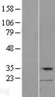 TMPRSS12 Human Over-expression Lysates NM_182559