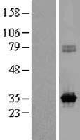 KCNRG Human Over-expression Lysates NM_173605