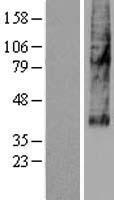 ls283537 slc46a3 human over expression lysates nm 181785 wb testing 1