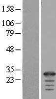 FAM177A1 Human Over-expression Lysates NM_001079519