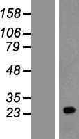 FAM177A1 Human Over-expression Lysates NM_173607