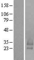 C16orf79 (BRICD5) Human Over-expression Lysates NM_182563