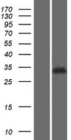 PGP Human Over-expression Lysates NM_001042371