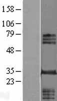 ls283899 ino80e human over expression lysates nm 173618 wb testing 1
