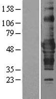 ls283933 znf843 human over expression lysates nm 001136509 wb testing 1