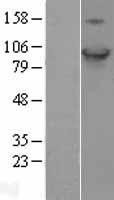 HID1 Human Over-expression Lysates NM_030630
