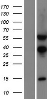 TSEN54 Human Over-expression Lysates NM_207346