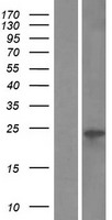 ls284013 vmo1 human over expression lysates nm 182566 wb testing 1
