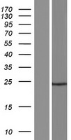 ls284067 cfap97d1 human over expression lysates nm 001136483 wb testing 1