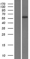 SLC13A5 Human Over-expression Lysates NM_177550