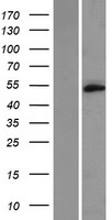 ls284114 tmem102 human over expression lysates nm 178518 wb testing 1