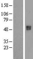 SLC26A11 Human Over-expression Lysates NM_173626