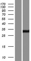 Endonuclease V (ENDOV) Human Over-expression Lysates NM_001164637
