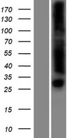 Endonuclease V (ENDOV) Human Over-expression Lysates NM_173627