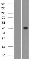 ls284161 gdpd1 human over expression lysates nm 182569 wb testing 1
