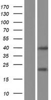 LGALS9B Human Over-expression Lysates NM_001042685