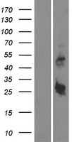 C18orf26 (DYNAP) Human Over-expression Lysates NM_173629