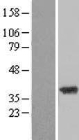 ZADH2 Human Over-expression Lysates NM_175907