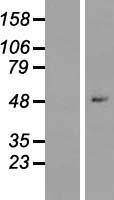 ZNF547 Human Over-expression Lysates NM_173631