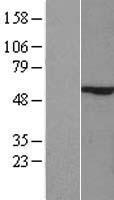 ls284307 zik1 human over expression lysates nm 001010879 wb testing 1