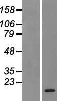 CXCL17 Human Over-expression Lysates NM_198477