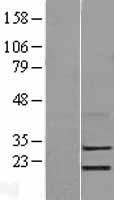 LYPD5 Human Over-expression Lysates NM_001031749